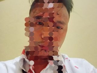 Dua Minggu Berlalu, Korban Penganiayaan di Depan Rich Club Kendari Desak Polisi Tangkap Pelaku